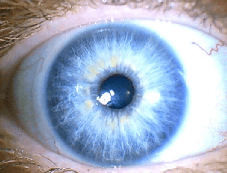 עיניים כחולות